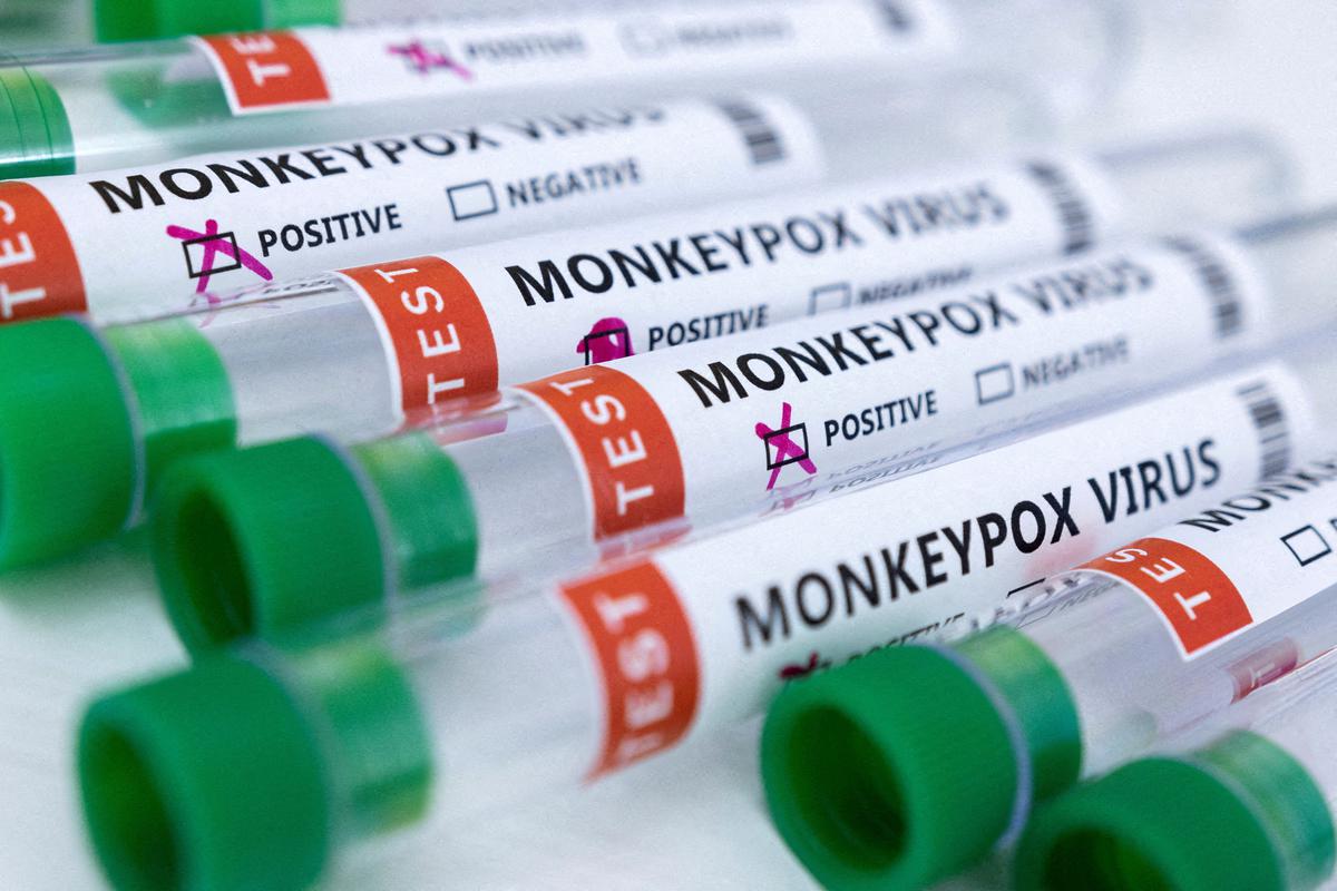 Expats face the brunt as Monkeypox is detected in Kerala